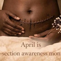 The Strength Behind Scar