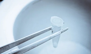 Why can't men freeze their sperms after 40 ?